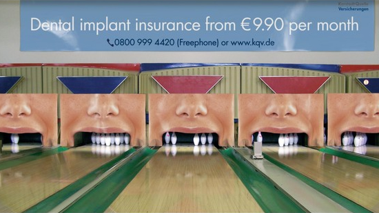 保険会社（KarstadtQuelle保険）のレジャー施設広告。歯科インプラント保険は月額9.9ユーロから、ボーリングのピンは欠損する歯を連想させます。＜ドイツ＞